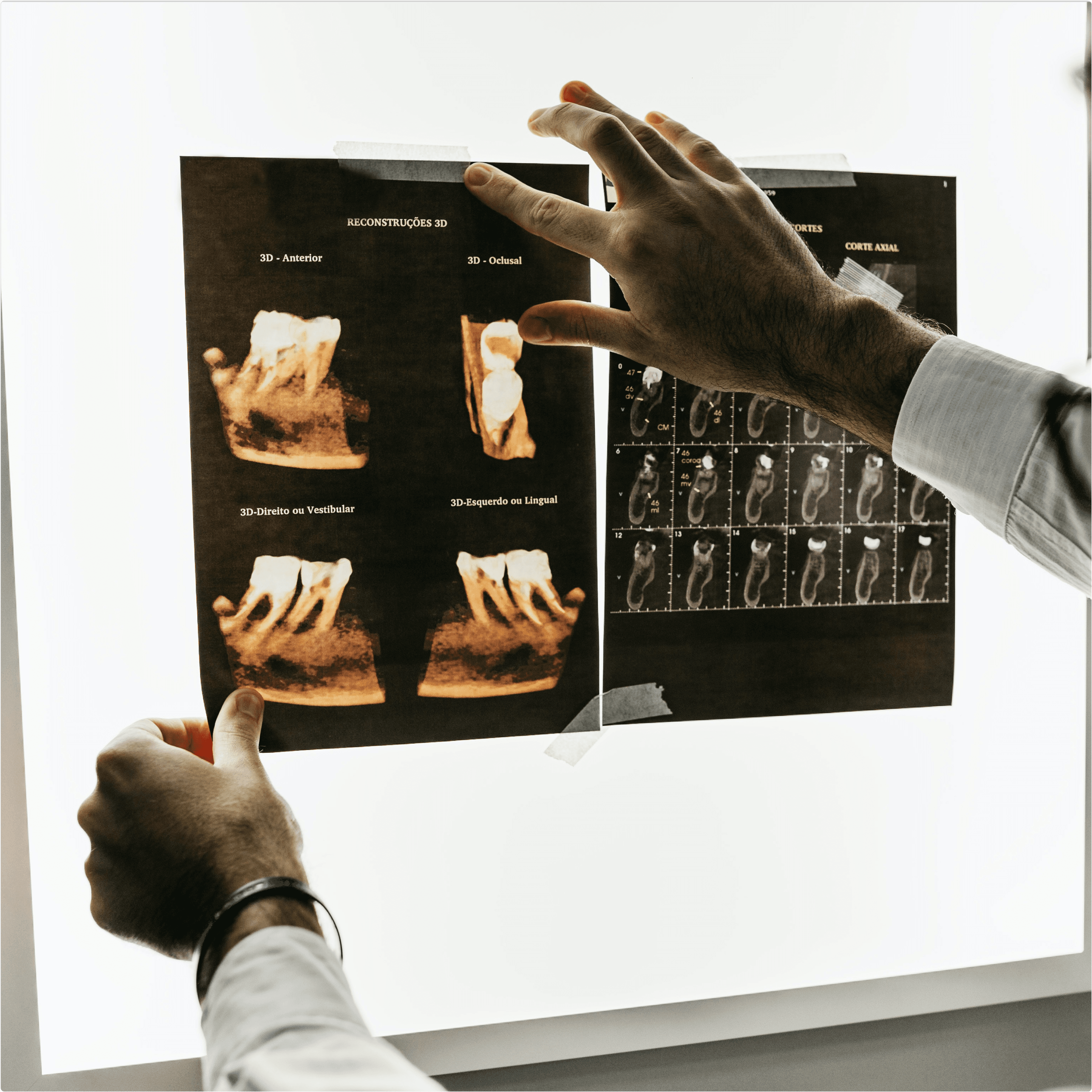 Doctor pointing to X-ray