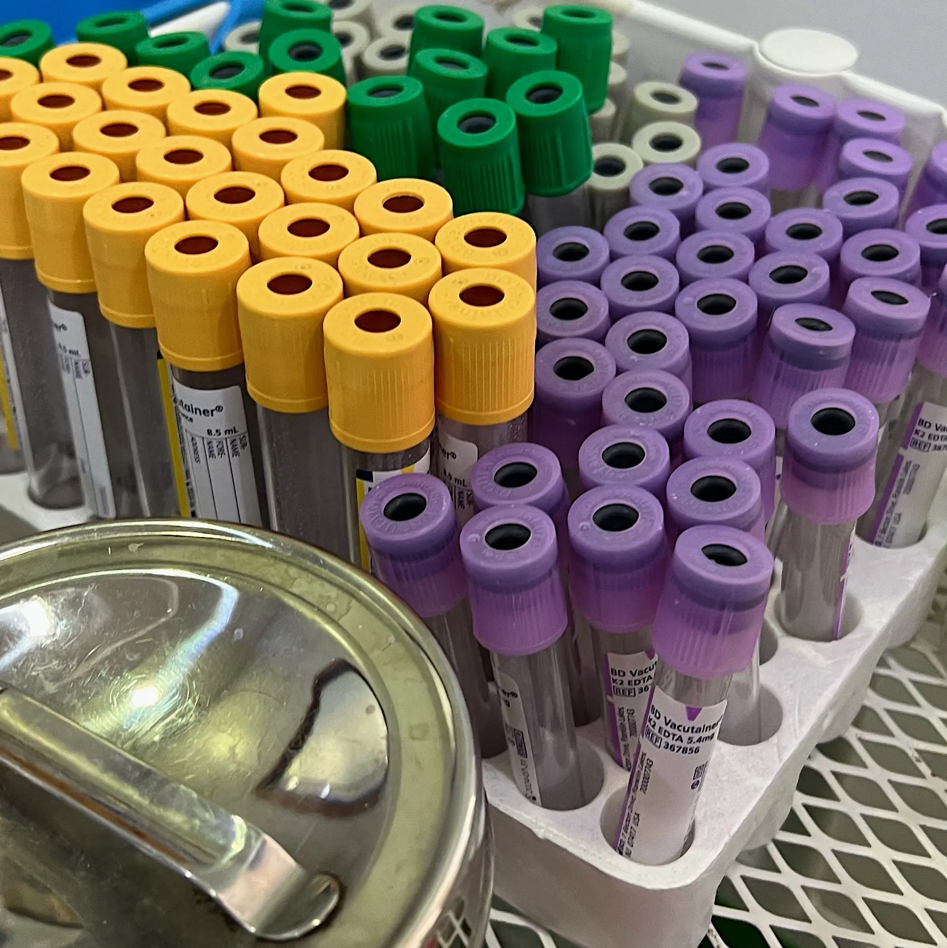 Modified Glucose Tolerance Test (MGTT)